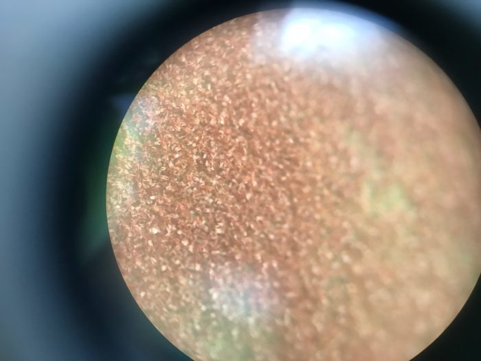 顕微鏡でのぞき込むとクルっと先が丸まった胞子の殻が葉の裏を覆っています。この殻の中に胞子のうが隠れています。